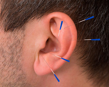 acupuntura auricular en Palma de Mallorca